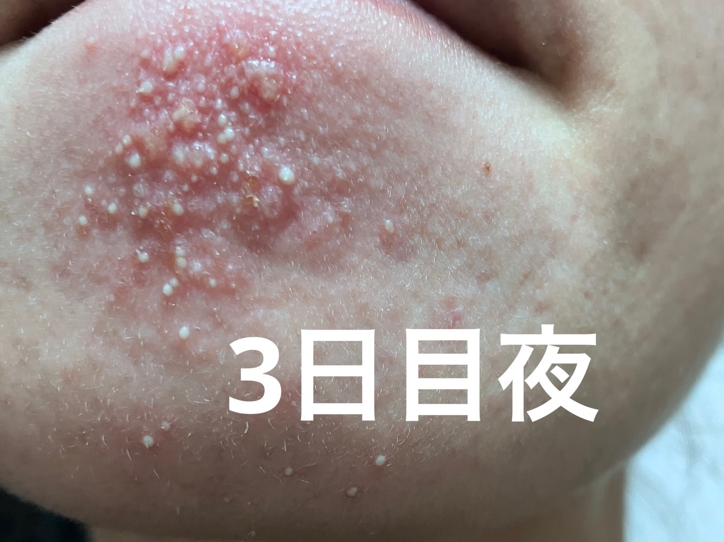 ソフティモ 泡洗顔(セラミド)/ソフティモ/泡洗顔を使ったクチコミ(5枚目)