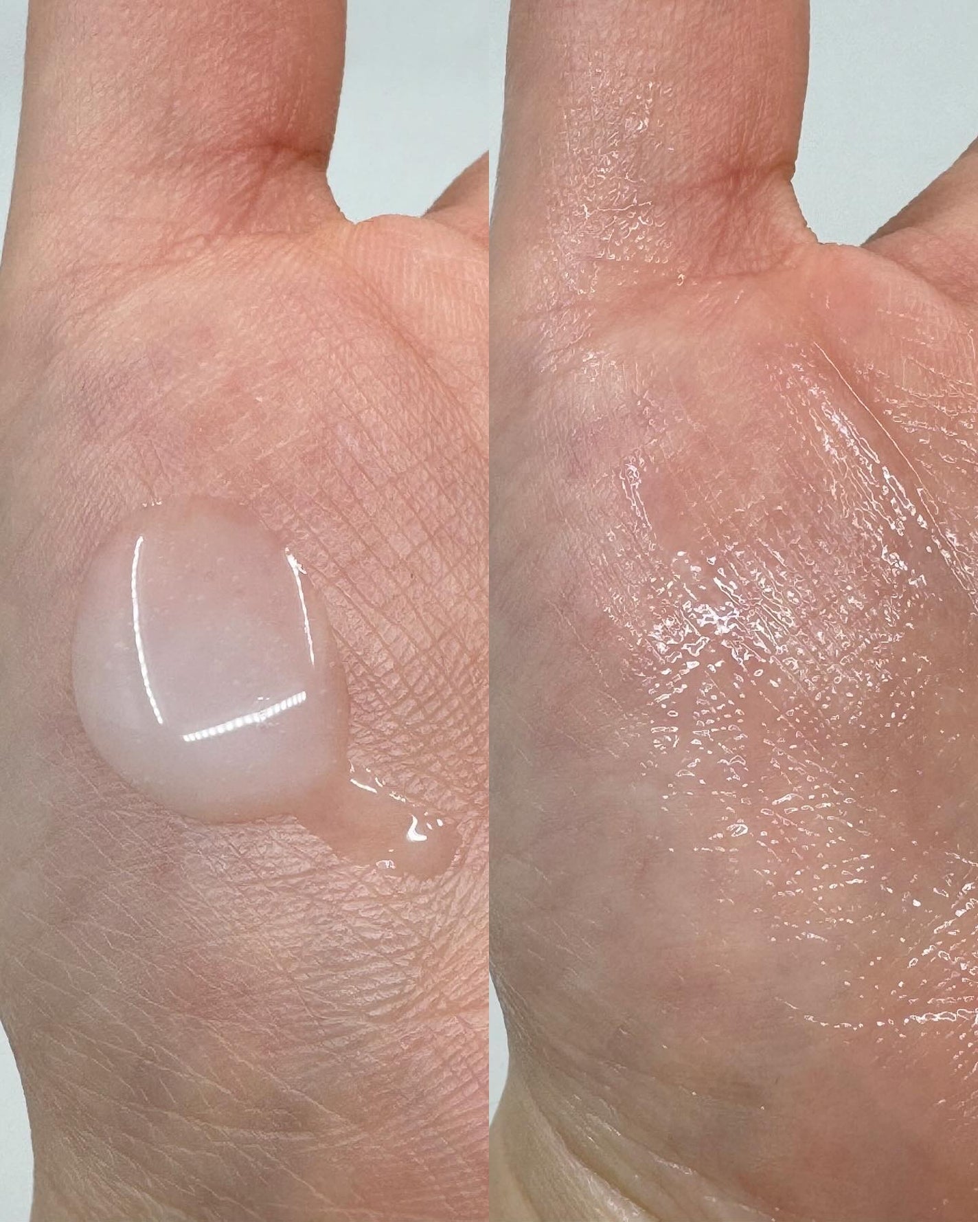 インテンシブAM7 セラム/Raftel/美容液を使ったクチコミ(5枚目)