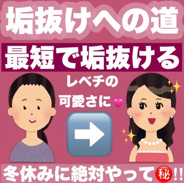 とゆめ☁️フォロバ  on LIPS 「最短で垢抜ける㊙️‼︎　　レベチの可愛さになるための垢抜けへの..」（1枚目）