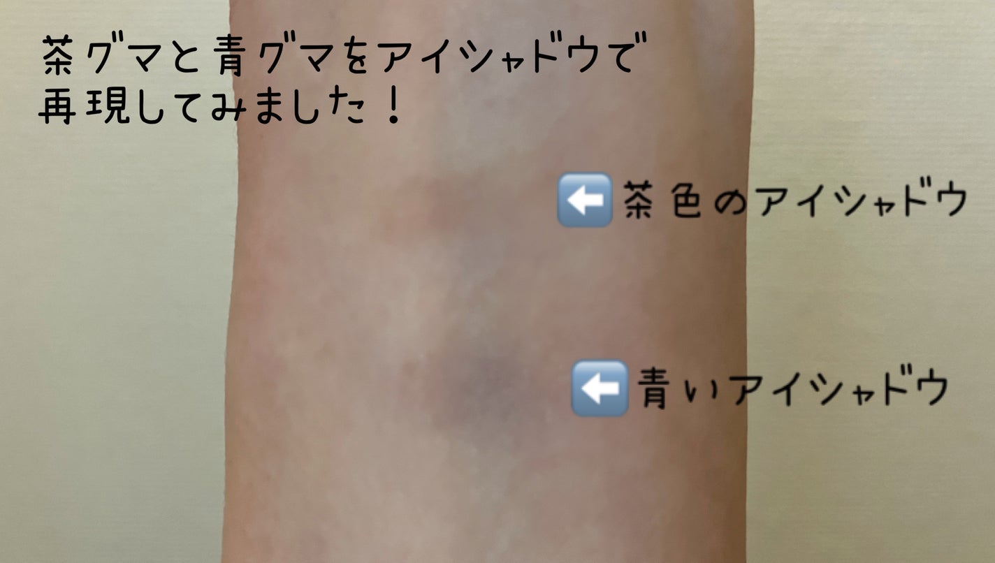 リシェ レッドトリック アイコンシーラー/Visée/パレットコンシーラーを使ったクチコミ(3枚目)