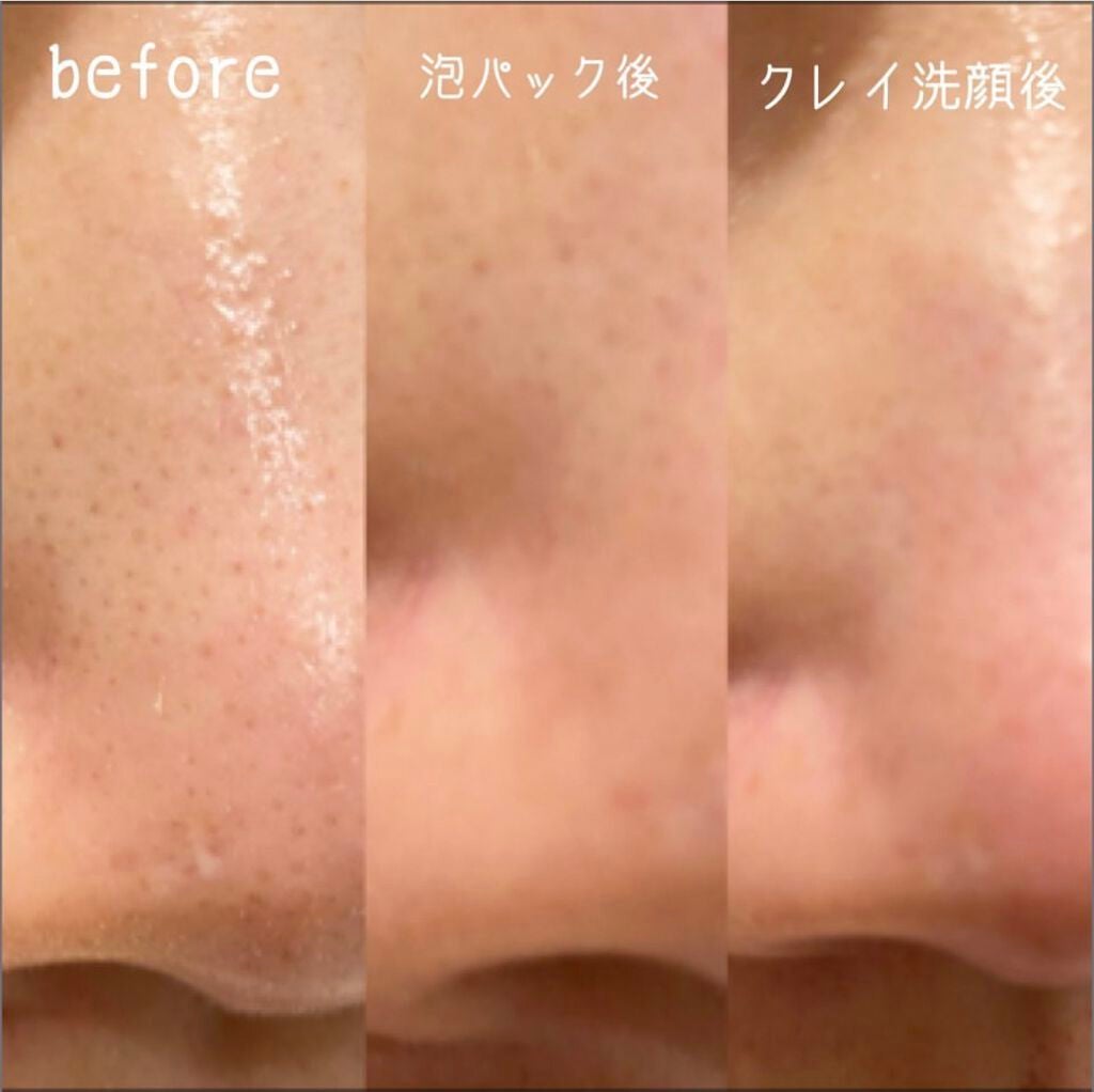 デュオ ザ ホワイトクレイクレンズ/DUO/洗顔フォームを使ったクチコミ(3枚目)