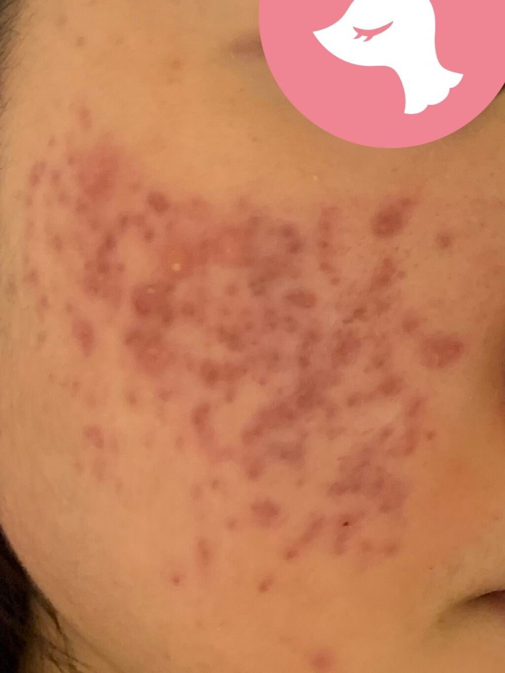 化粧水・敏感肌用・高保湿タイプ/無印良品/化粧水を使ったクチコミ(2枚目)