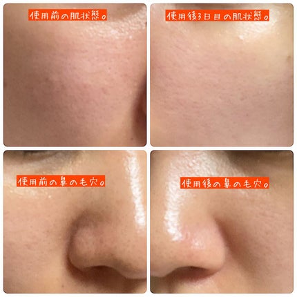 PLUMINUS/mous./美顔器・マッサージを使ったクチコミ(2枚目)