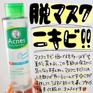 .

夏の暑い時期〝マスク蒸れによるニキビ〟気になりませんか？😭
実際私も急に暑くなってきて、マスクゾーンにポツッとできちゃうことがたまにあります💦

きっと同じお悩みの方も多いはず💦
そんな時には「メンソレータムアクネス 薬用クリア化粧水」常備しておくことをお勧めします❣️

20代、30代のニキビ悩みの方にもおすすめ！

マスクの摩擦や着脱による乾燥が原因となって、過剰な皮脂が分泌されると皮脂や角質が詰まってしまってアクネ菌が繫殖😭
それによってニキビができちゃうんです💦
 
メンソレータムアクネス 薬用クリア化粧水はアクネ菌繁殖予防してくれます🙌🏻
殺菌成分▶︎イソプロピルメチルフェノール
抗炎症成分▶︎グリチルリチン酸ジカリウム
が配合されています💡 
さらに洗顔後に拭き取ることで、ニキビの原因となる過剰な皮脂や古い角質をふき取ってニキビ予防💡
グリコール酸（AHA）と乳酸（角質柔軟成分）配合✨
毛穴の奥からニキビを予防✨ 
うるおい成分としてビタミンC誘導体（ビタミンCリン酸Mg）配合です🎵

ちなみに私、、恥ずかしいですが、この時期背中にニキビができるんです🫣
なので頑張って手を伸ばして背中にも使ってます😳

マスク蒸れによるニキビはもちろん、背中ニキビにも❗️
予防対策としてぜひ使ってみてください🧡

販売名：アクネスＣ化粧水Ｌ 
#アクネス#メンソレータムアクネス#化粧水#ロート製薬_pr #さよならコンプレックス  #ノーファンデ宣言 の画像 その0