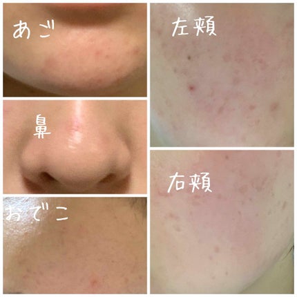 薬用しみ対策 美白化粧水/メラノCC/化粧水を使ったクチコミ(2枚目)