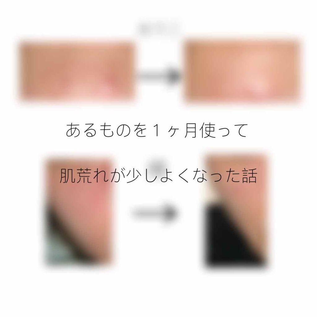 ペアアクネクリームW(医薬品)/ペア/その他を使ったクチコミ（1枚目）