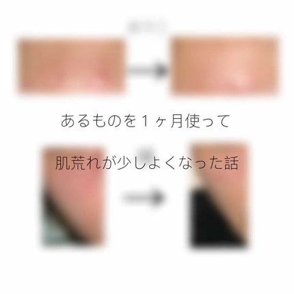 ãã¢ã¢ã¯ãã¯ãªãŒã W(å»è¬å)/ãã¢/ãã®ä»ã䜿ã£ãã¯ãã³ãïŒ1æç®ïŒ