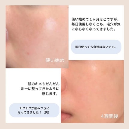 ゼロ1DAYエクソソームショット2000/MEDICUBE/美容液を使ったクチコミ(7枚目)