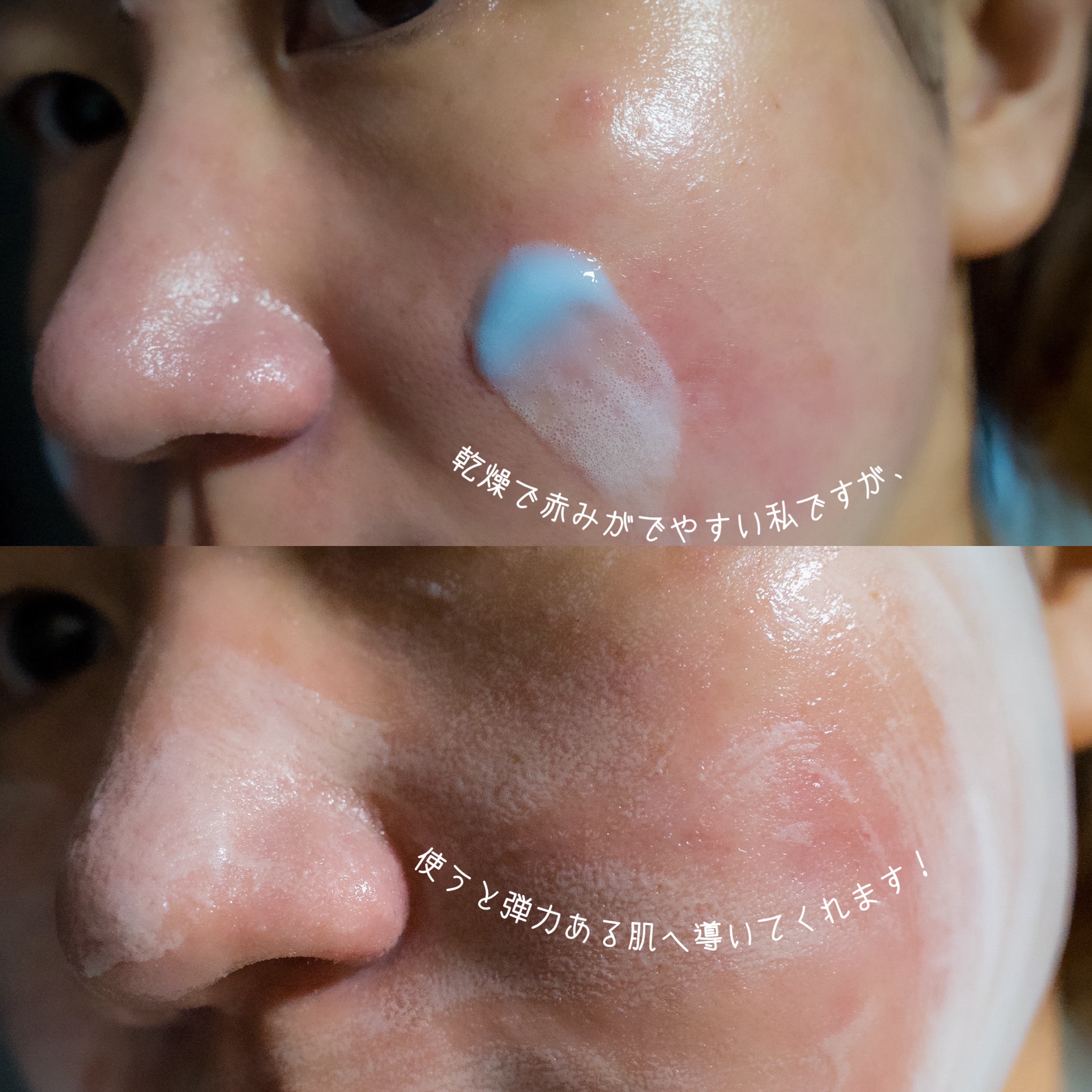 ペプチド ボリューム シグネチャーエッセンス/DR.PEPTI/美容液を使ったクチコミ（3枚目）