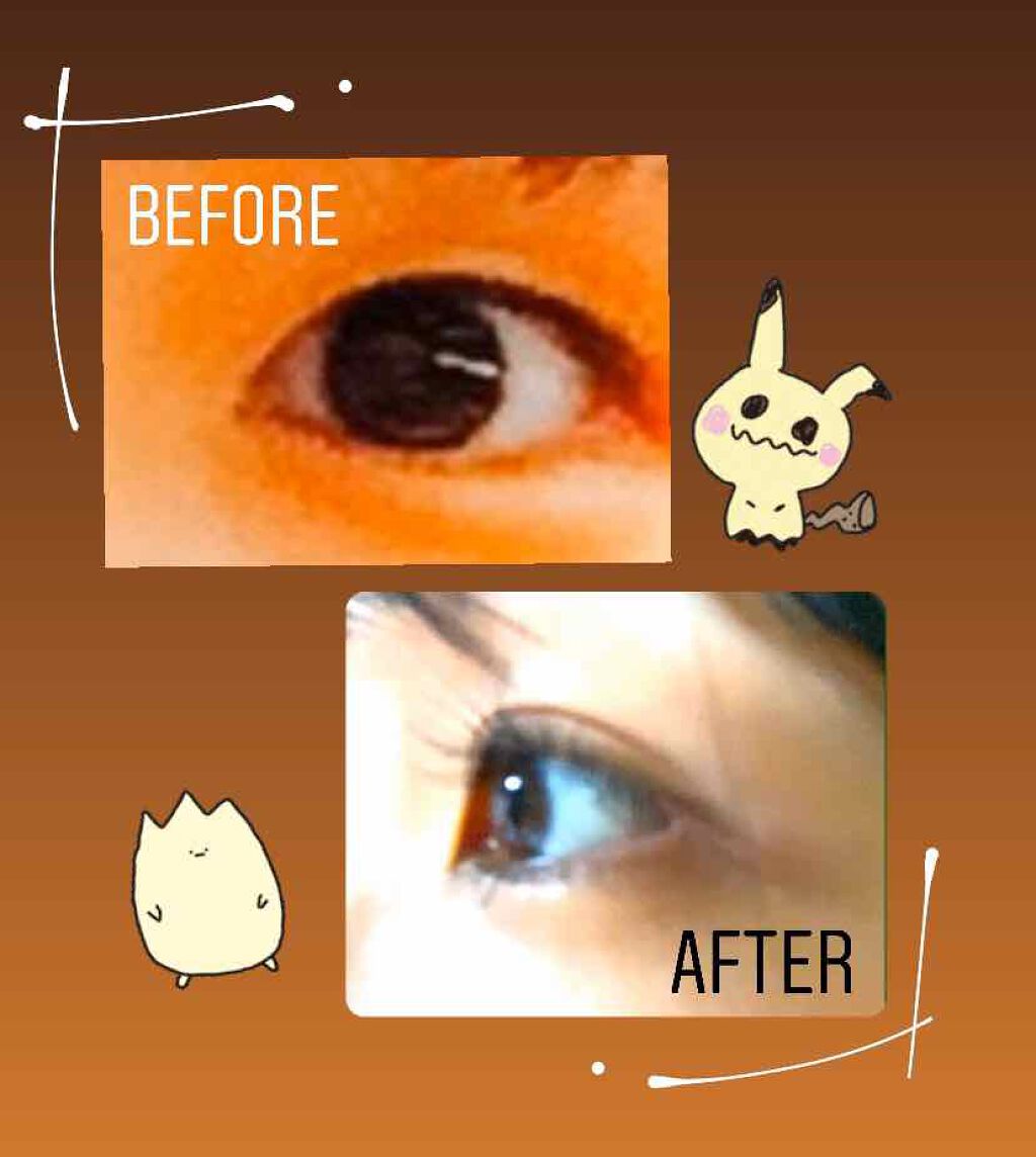 ワンダーアイリッドテープ Extra/D-UP/二重まぶた用アイテムを使ったクチコミ（1枚目）