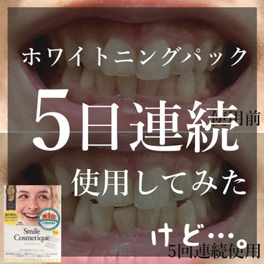 Smile Cosmetique プレミアム ティースホワイトパックのクチコミ「最近歯の黄ばみが気になる…。
絶対前よりくすんでる気がする(；_；)と思って気になって仕方なか.....」（1枚目）