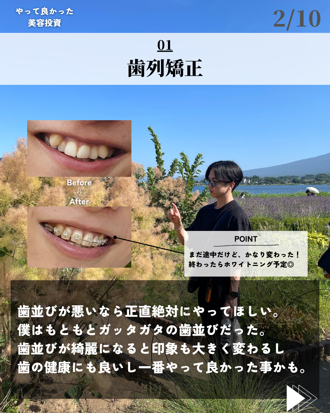 ほづ|メンズ美容で清潔感を上げる on LIPS 「やって良かった美容投資7選どれも本当にやって良かった!特に・歯..」(2枚目)
