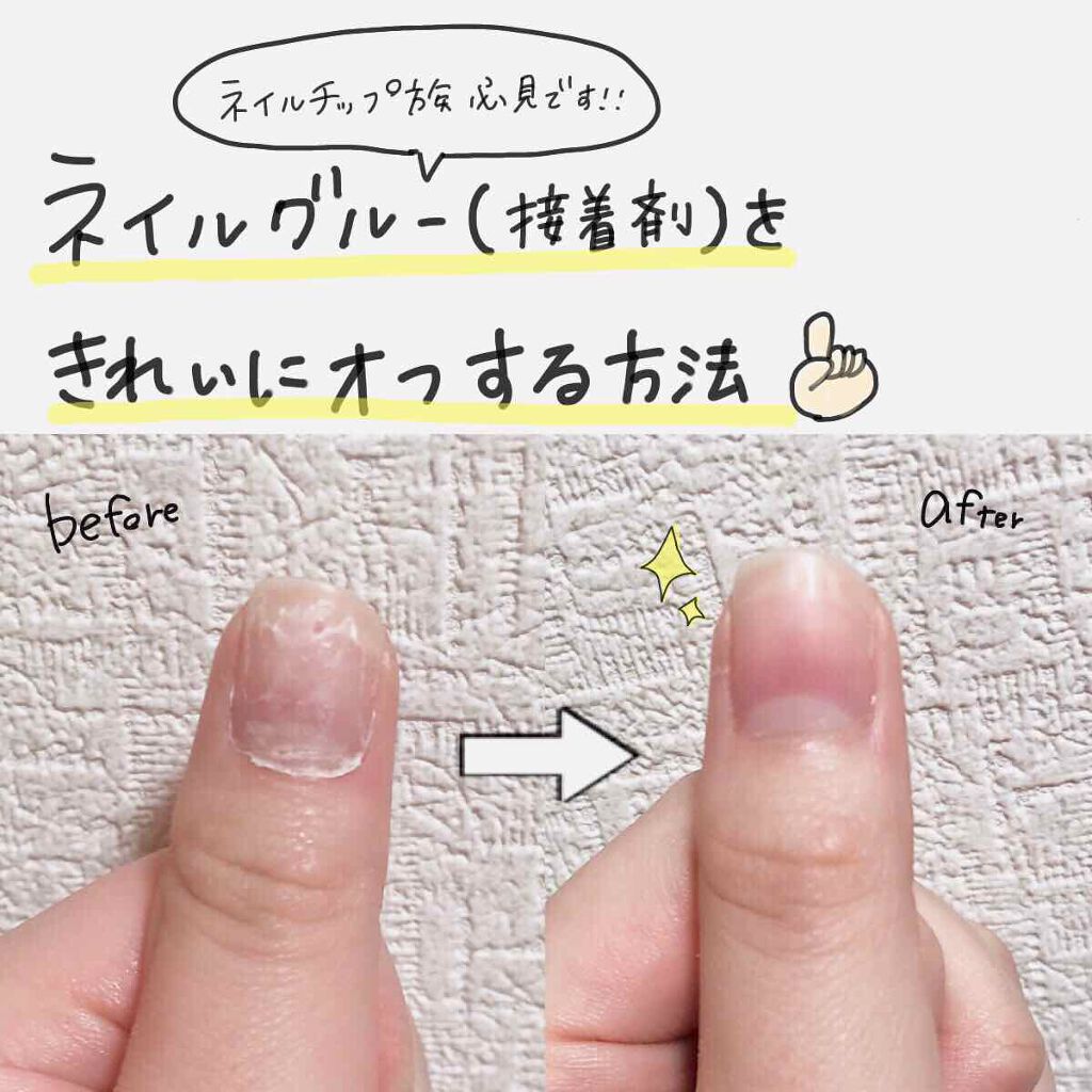 ネイルリペアにも使える ネイルグルー ネイルチップ 用接着剤 ネイルパーツ