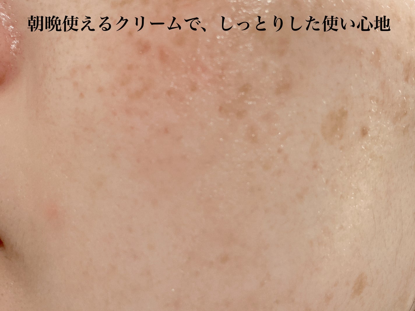 アセロラダークスポット&ブレミッシュ ケア クリーム/RAVIEL/フェイスクリームを使ったクチコミ(6枚目)