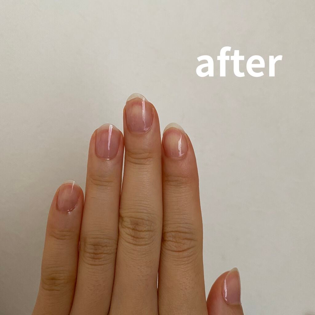 アロマキューティクルオイル/D-UP/ネイルオイル・トリートメントを使ったクチコミ(3枚目)