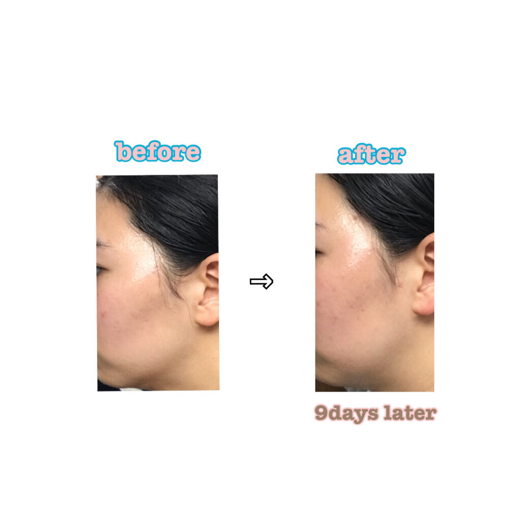 デュオ ザ クレンジングバーム/DUO/クレンジングバームを使ったクチコミ（3枚目）