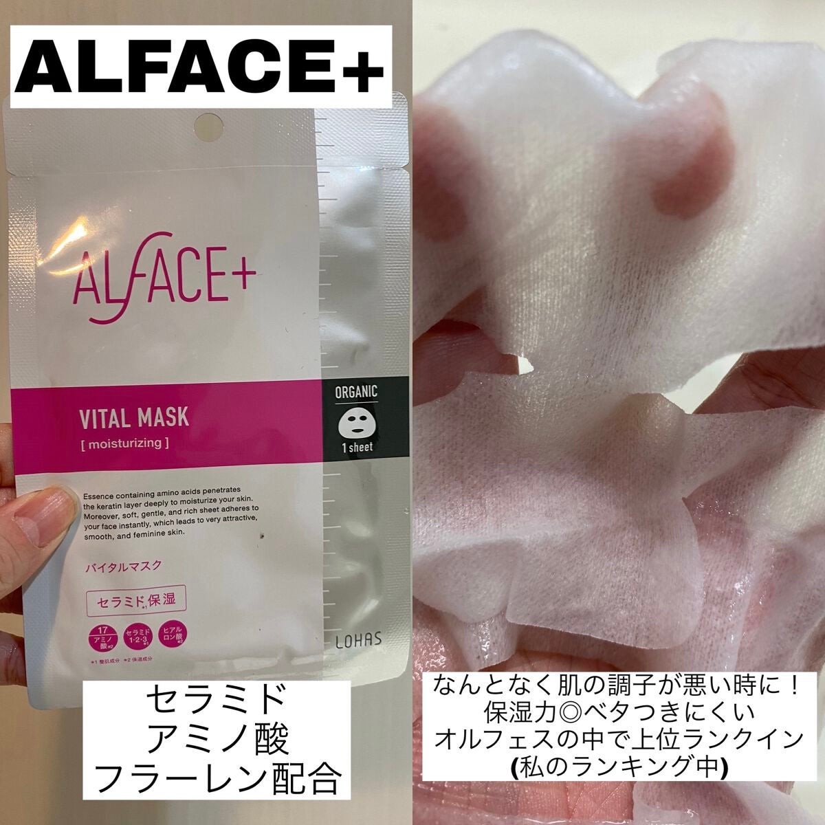 オルフェス バイタルマスク/ALFACE+/シートマスク・パックを使ったクチコミ(5枚目)