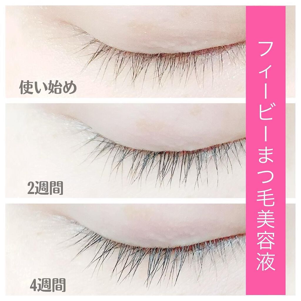 アイラッシュセラム Phoebe Beauty Upの口コミ エイジングケアにおすすめのまつげ美容液 Phoebebeaut By ちーちやん 混合肌 Lips