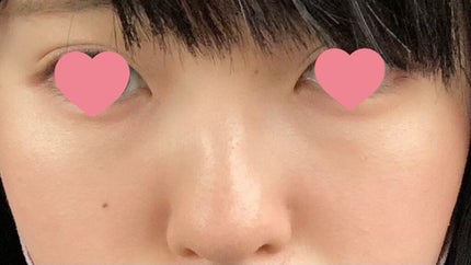 マットラディアンス ベイクドパウダー ハイライト01/ローラ メルシエ/パウダーハイライトを使ったクチコミ(3枚目)