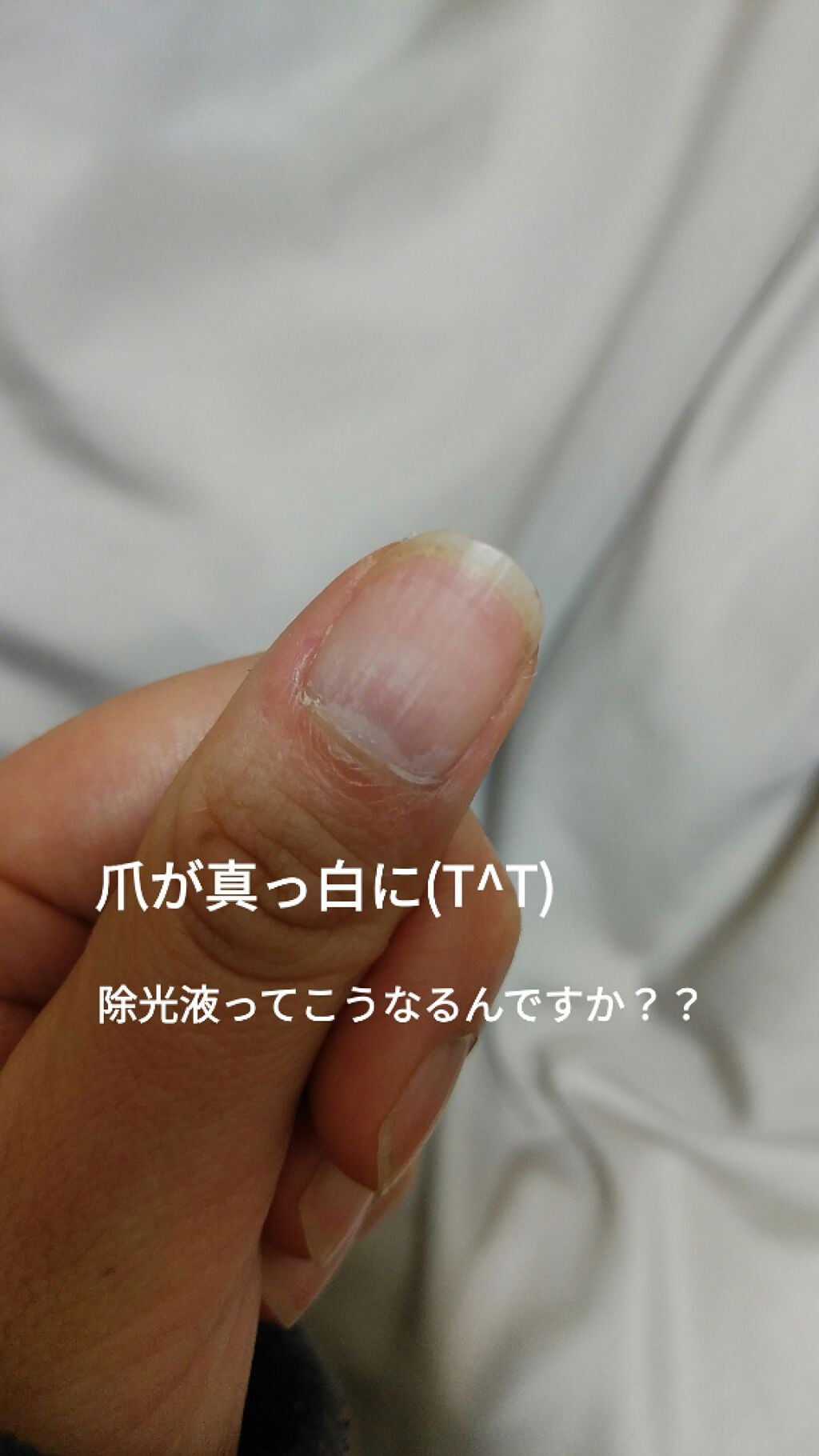 除光液/ちふれ/除光液を使ったクチコミ(2枚目)