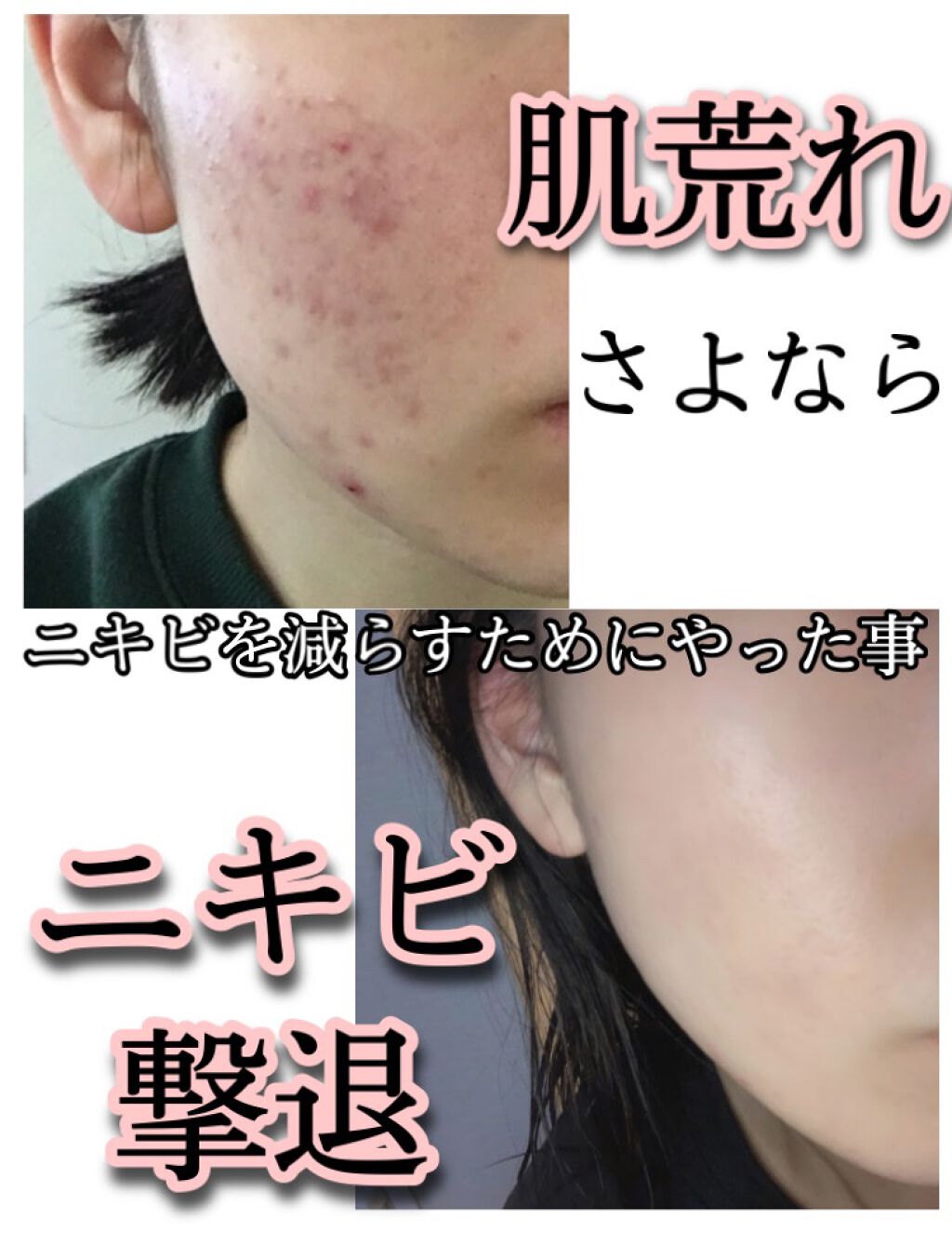 クレンジングリサーチ ウォッシュクレンジング N/クレンジングリサーチ/洗顔フォームを使ったクチコミ(1枚目)