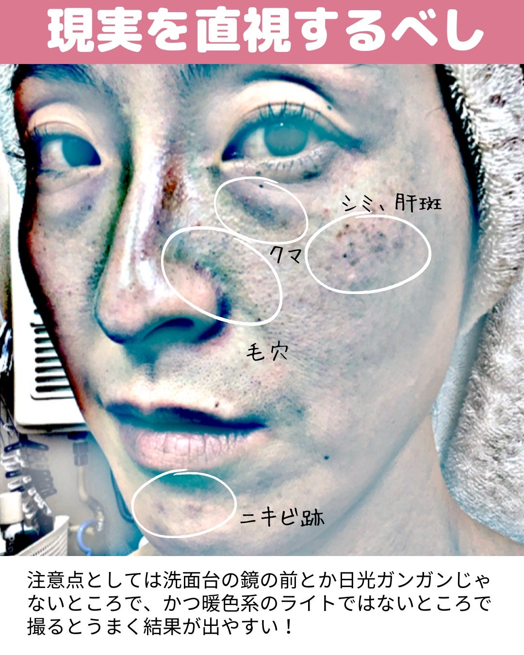 miisa/歳を重ねても"可愛い"をつくる美容法 on LIPS 「\衝撃/自分の肌と向き合う覚悟はできているか🫵𓇠𓇠𓇠𓇠𓇠𓇠𓇠𓇠..」(5枚目)