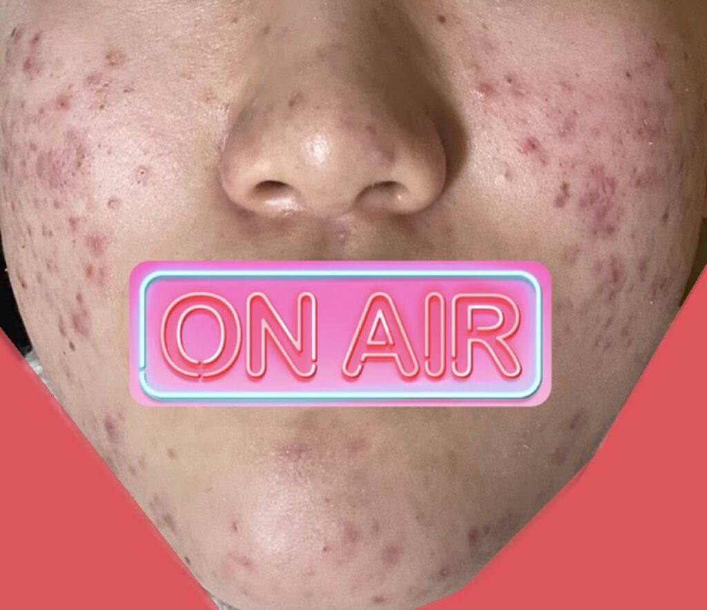 ホワイト洗顔クリーム/雪肌粋/洗顔フォームを使ったクチコミ（1枚目）