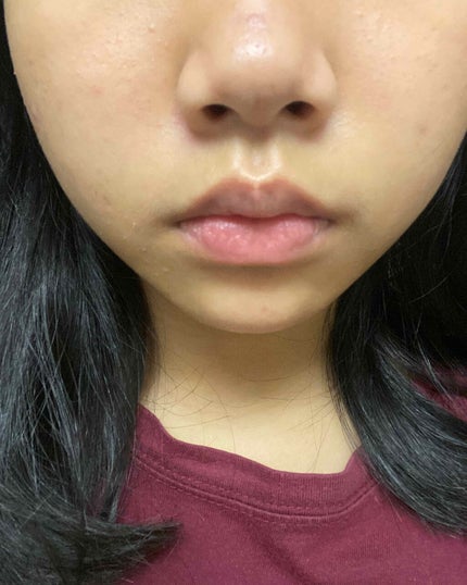 明色美顔水 薬用化粧水/美顔/化粧水を使ったクチコミ(2枚目)