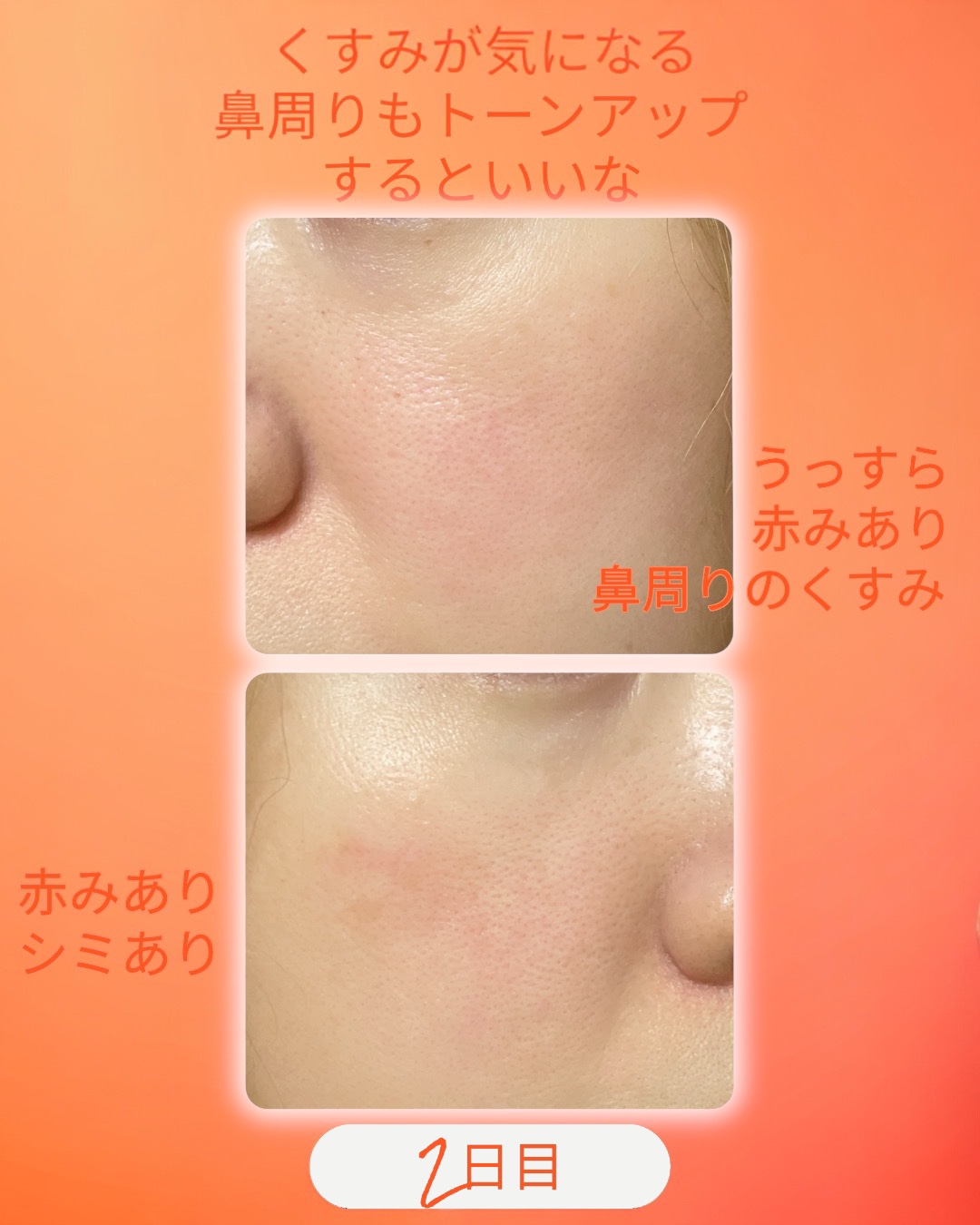 TXトーニングデイリーマスク/VT/その他スキンケアを使ったクチコミ（2枚目）