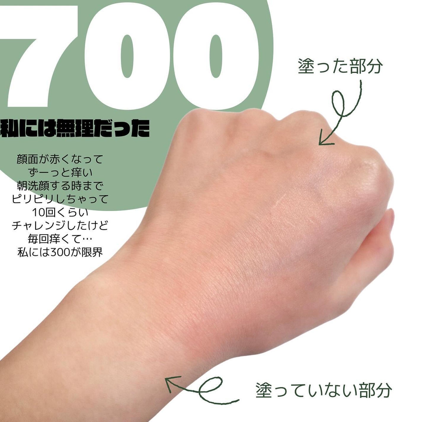 リードルショット100/VT/美容液を使ったクチコミ(5枚目)