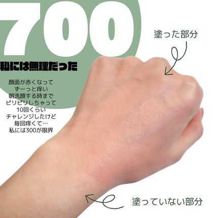 リードルショット100/VT/美容液を使ったクチコミ(5枚目)