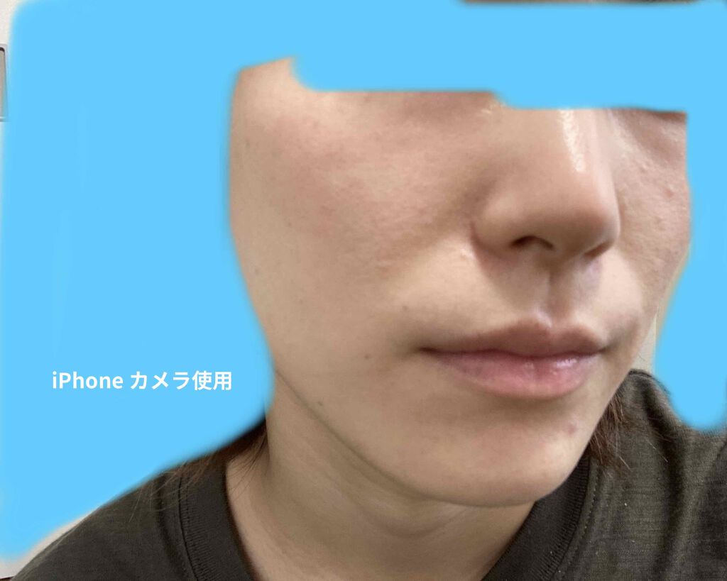 ドクタージャルト シカペア リカバー (第2世代)/Dr.Jart+/フェイスクリームを使ったクチコミ(2枚目)