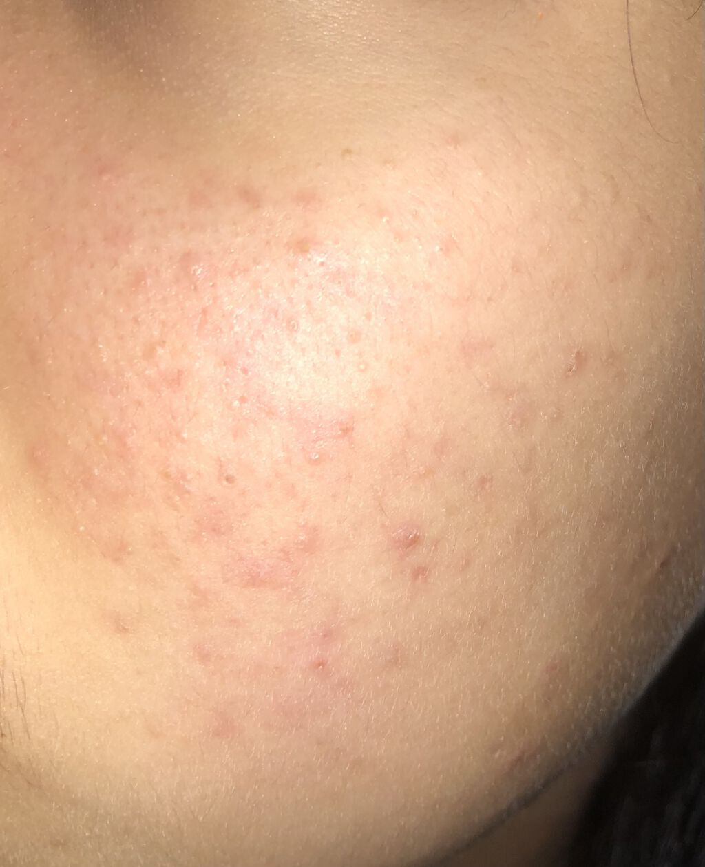 薬用保湿化粧水/オードムーゲ/化粧水を使ったクチコミ（3枚目）