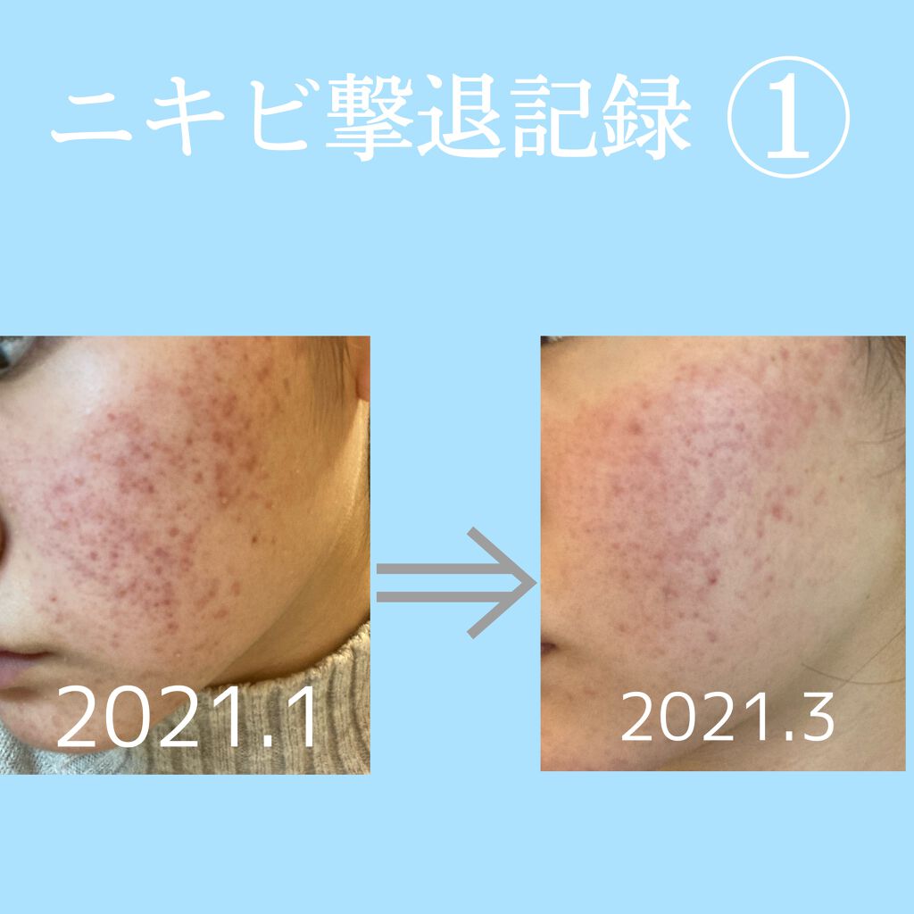 ハトムギ化粧水(ナチュリエ スキンコンディショナー R )/ナチュリエ/化粧水を使ったクチコミ（1枚目）