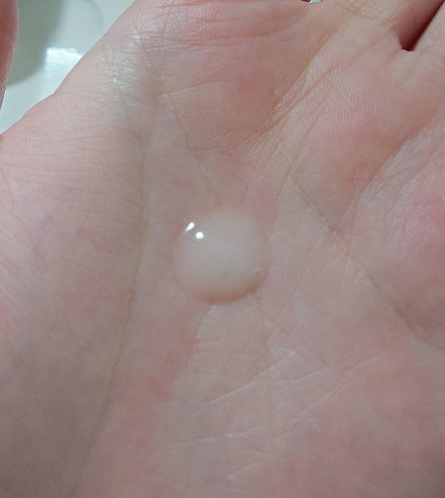 ビディ ニードルエッセンス NN/ビディ/美容液を使ったクチコミ(2枚目)