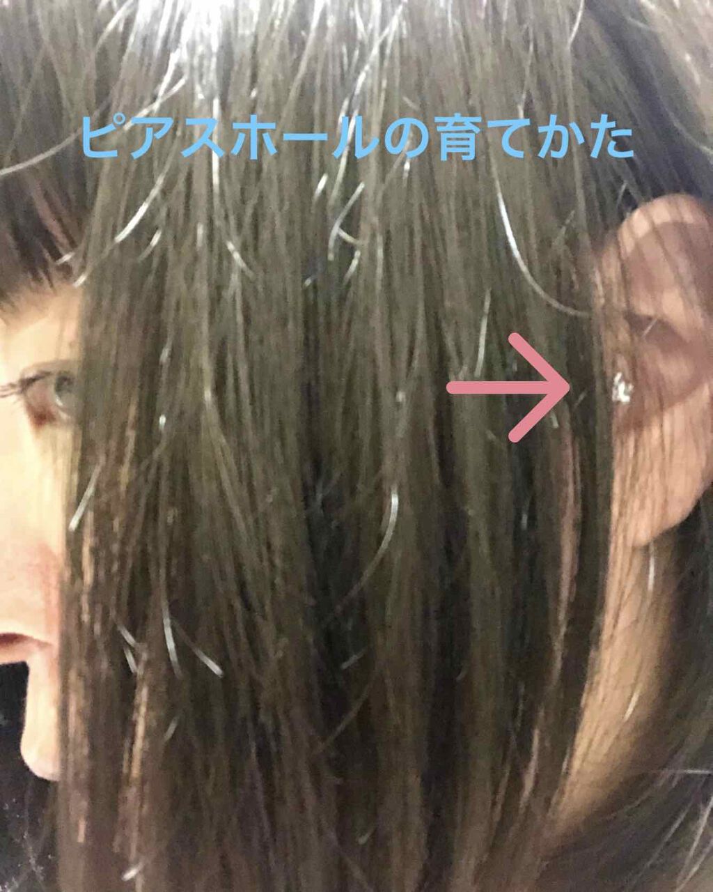 薬用ふわふわな泡洗顔/メンソレータム アクネス/泡洗顔を使ったクチコミ（1枚目）