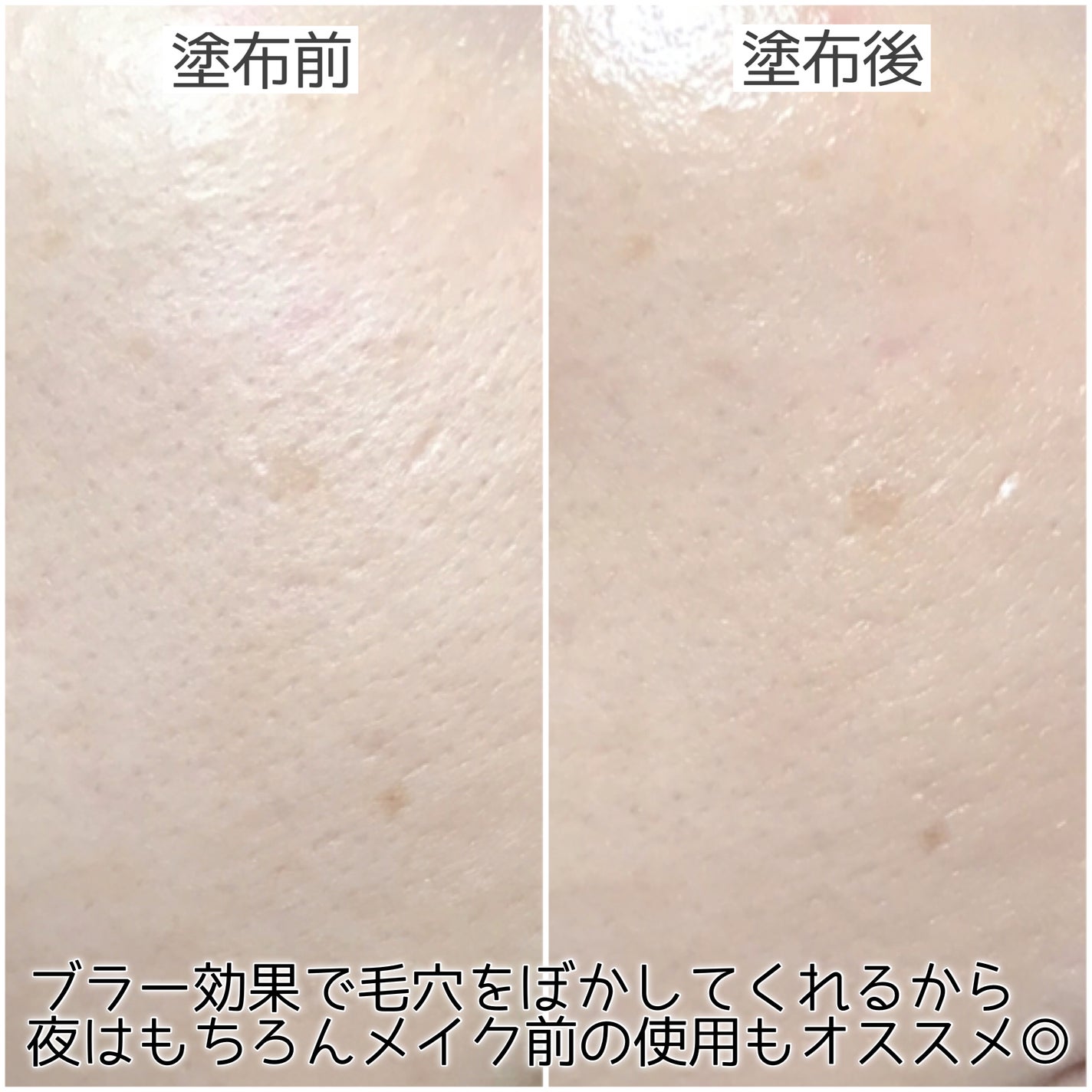 ポアセラリアルビフィダブラークリーム/MEDITHERAPY/フェイスクリームを使ったクチコミ(6枚目)