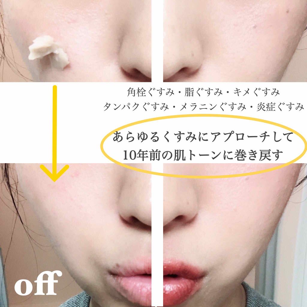 デュオ ザ クレンジングバーム ホワイトa/DUO/クレンジングバームを使ったクチコミ(4枚目)