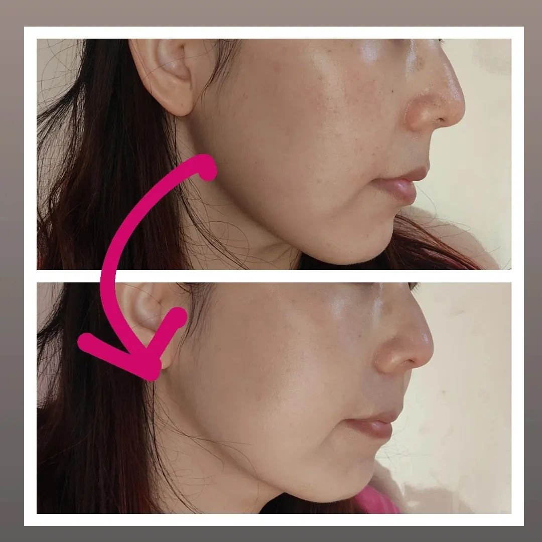 シカ クリア カバー クッション 02 Vanilla/ブラン/クッションファンデーションを使ったクチコミ（3枚目）