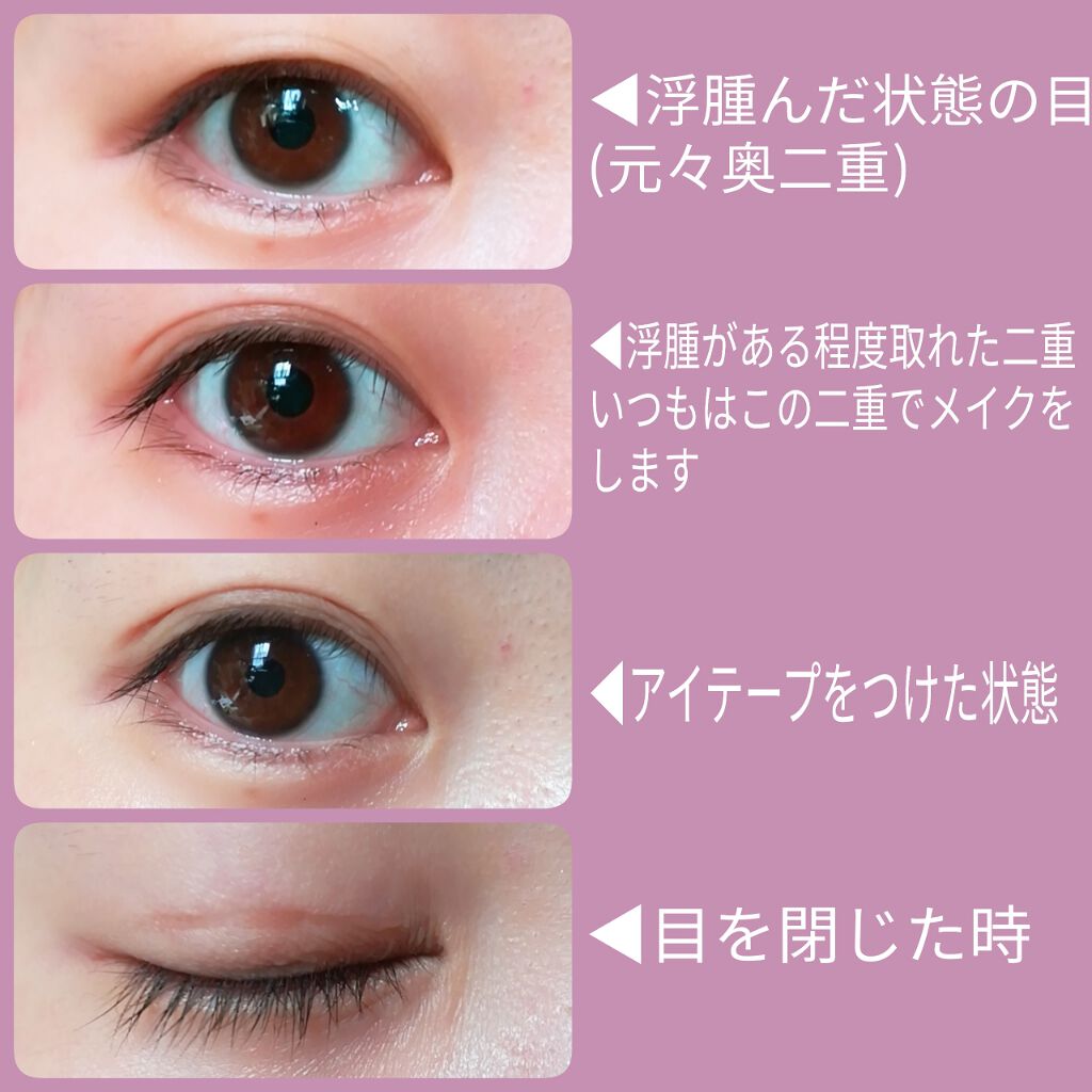 リキッドフィルム/ラクオリ/二重まぶた用アイテムを使ったクチコミ(2枚目)
