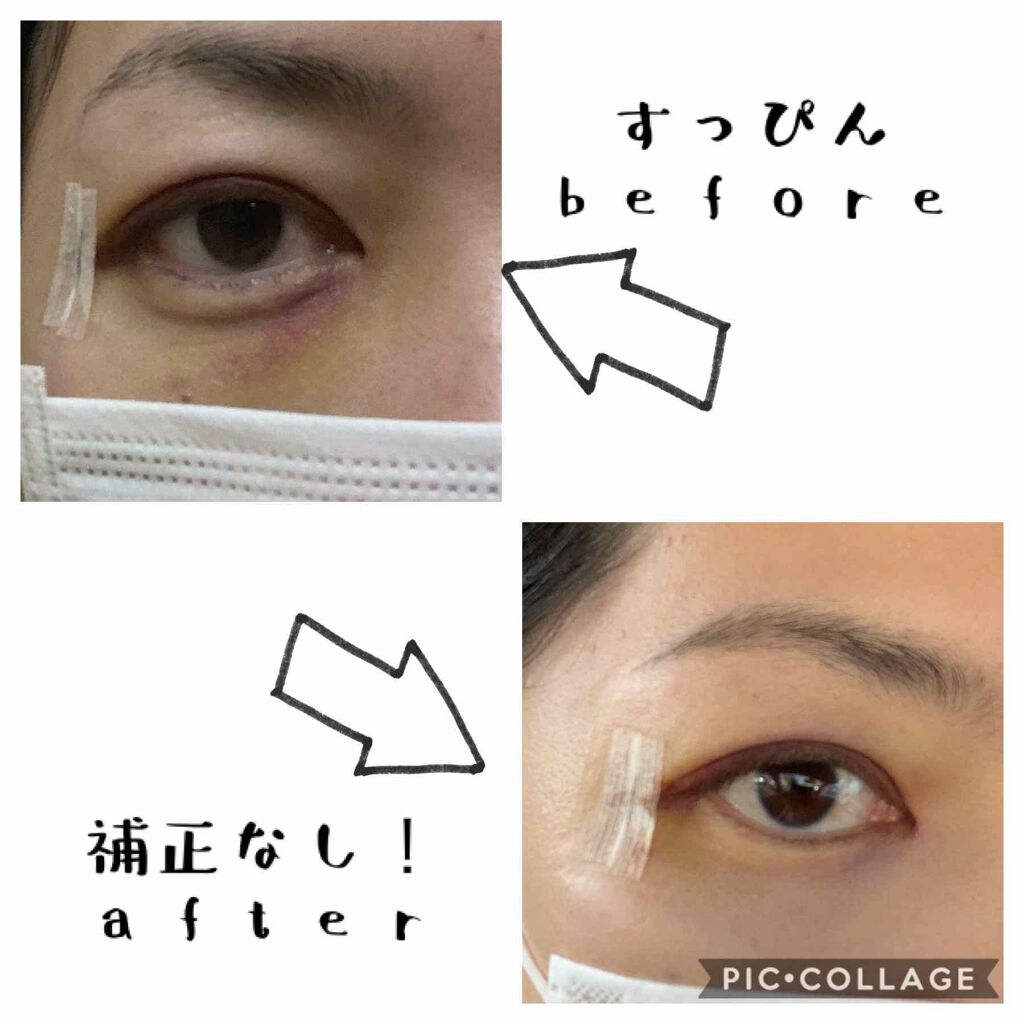 マジックコンシーラー/カリプソ/リキッドコンシーラーを使ったクチコミ(3枚目)