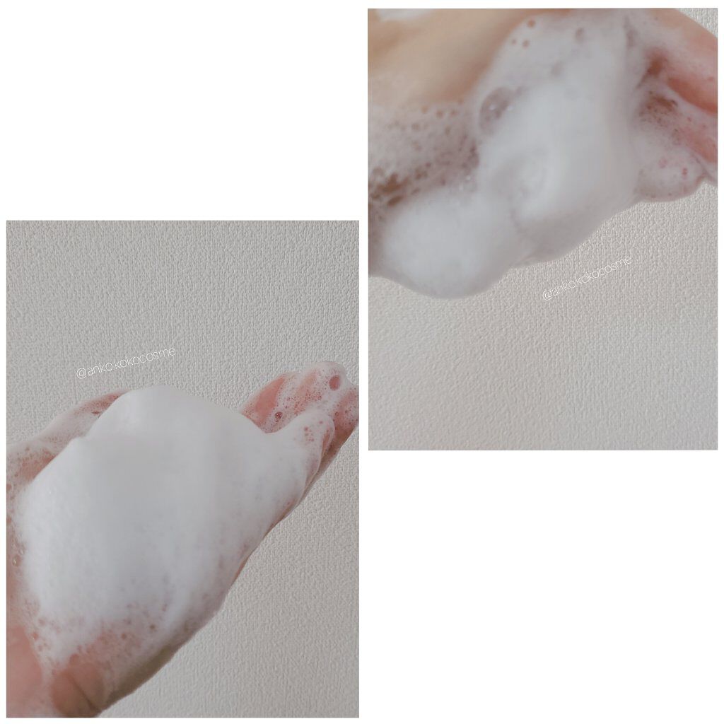 レッドB・Cスムージングクリーム/Dr.G/フェイスクリームを使ったクチコミ（3枚目）