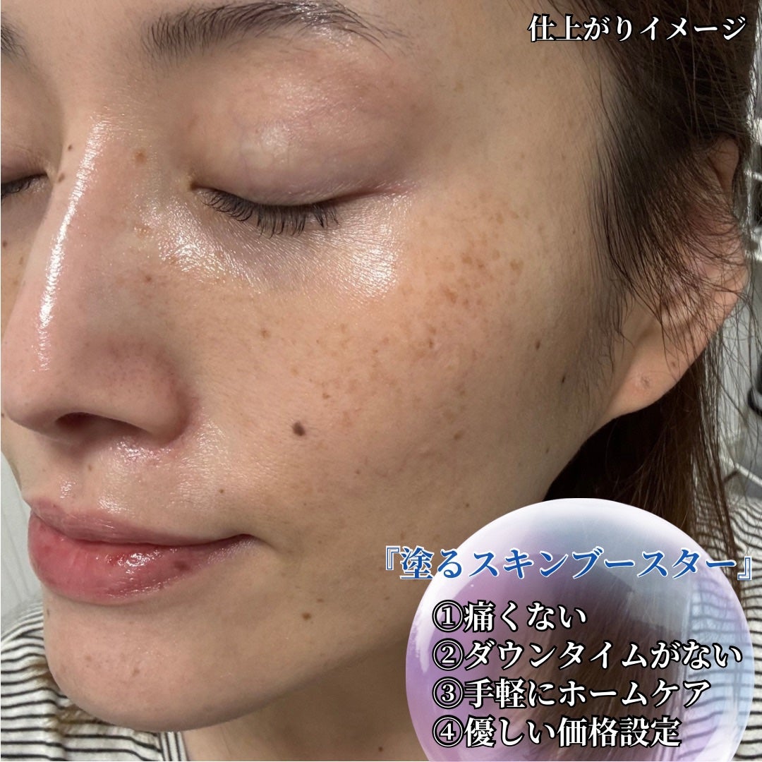 EXOBALL/id PLACOSMETICS/美容液を使ったクチコミ(6枚目)