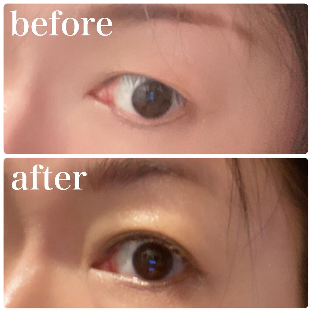 アイアクト リッチ エッセンス/スパイン製薬/アイケア・アイクリームを使ったクチコミ(4枚目)