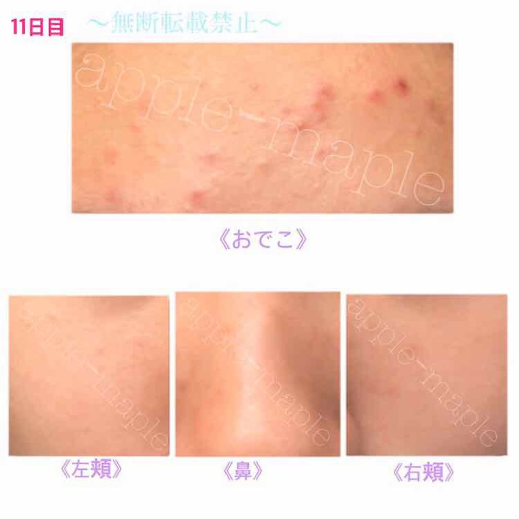 ロゼット 洗顔パスタ　荒性肌/ロゼット/洗顔フォームを使ったクチコミ（2枚目）