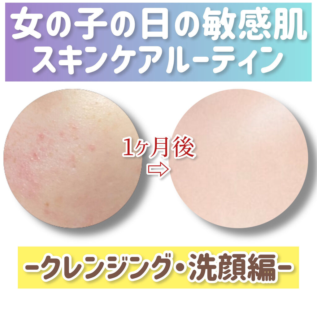 潤浸保湿 泡洗顔料/キュレル/泡洗顔を使ったクチコミ（1枚目）