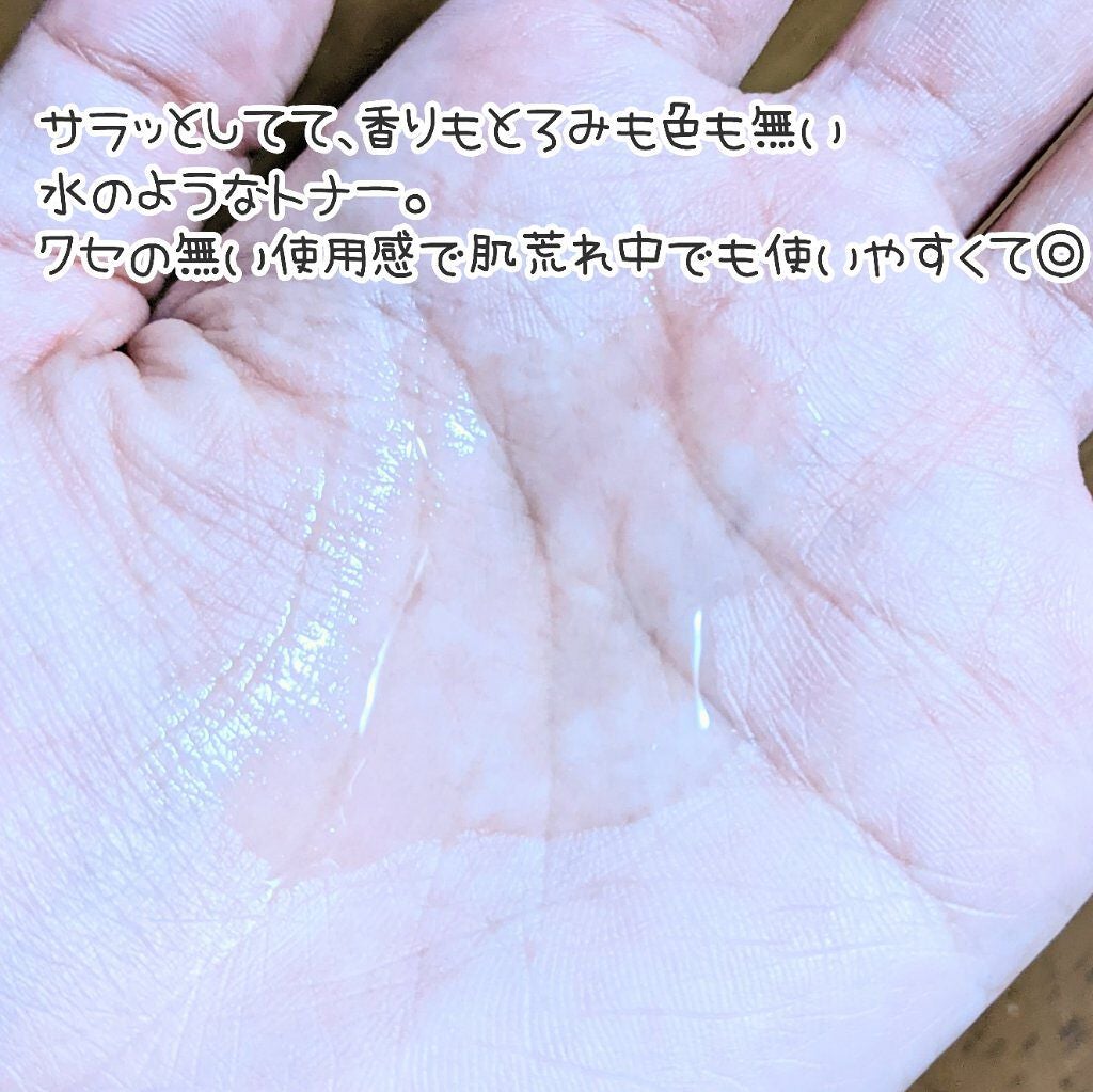 ドクダミ 77 スージングトナー/Anua/化粧水を使ったクチコミ(3枚目)