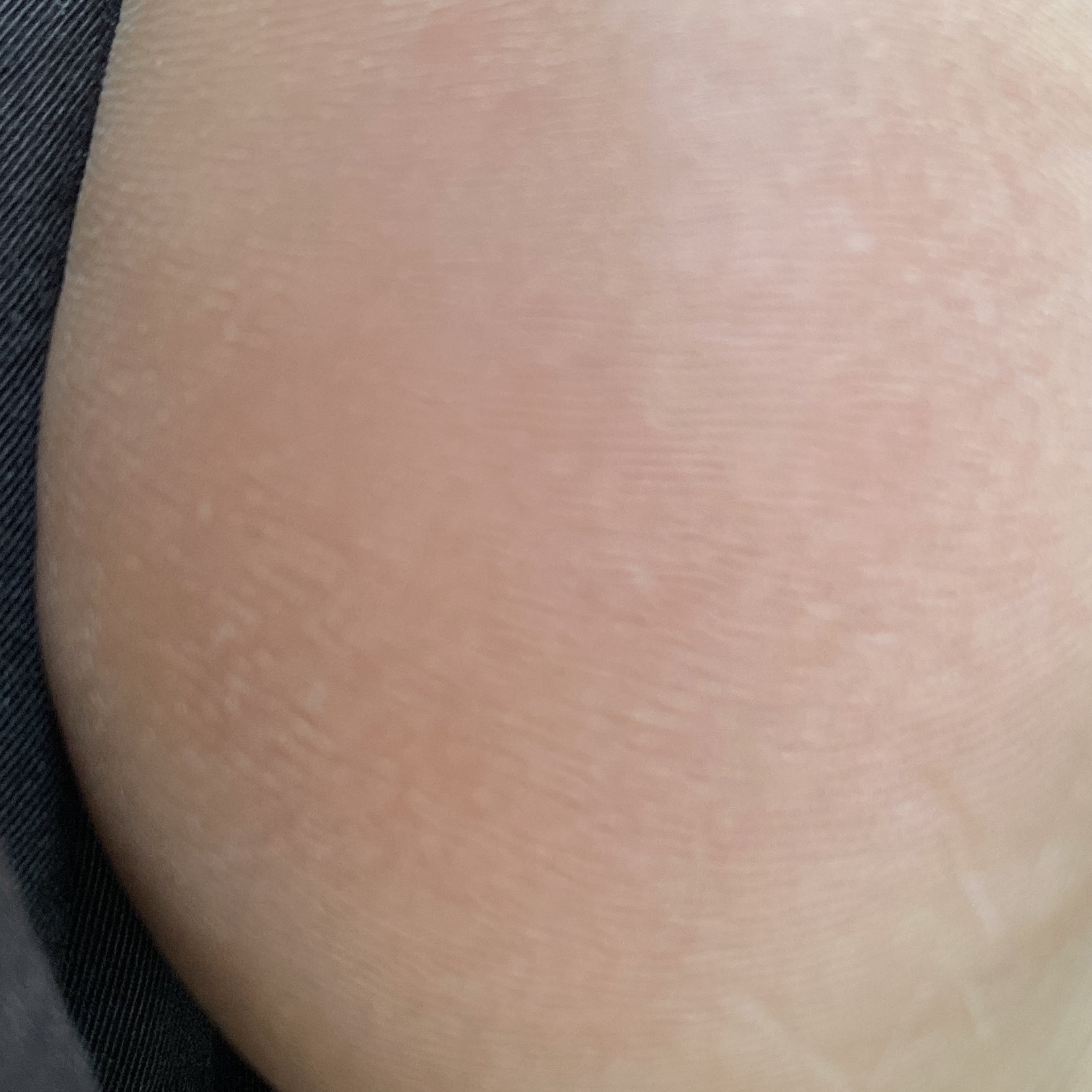 ゴウンバル クリーム/3WB/レッグ・フットケアを使ったクチコミ（3枚目）