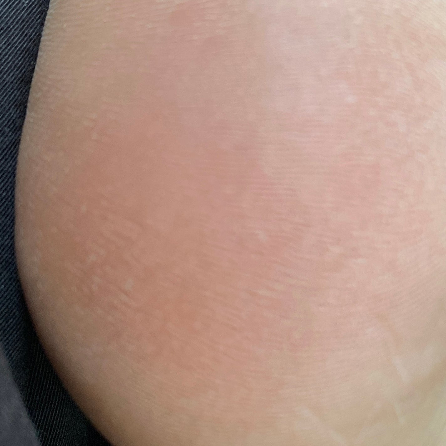 ゴウンバル クリーム/3WB/レッグ・フットケアを使ったクチコミ(3枚目)