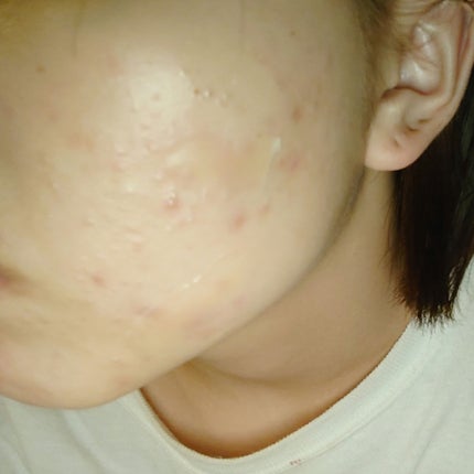 を使ったクチコミ(2枚目)